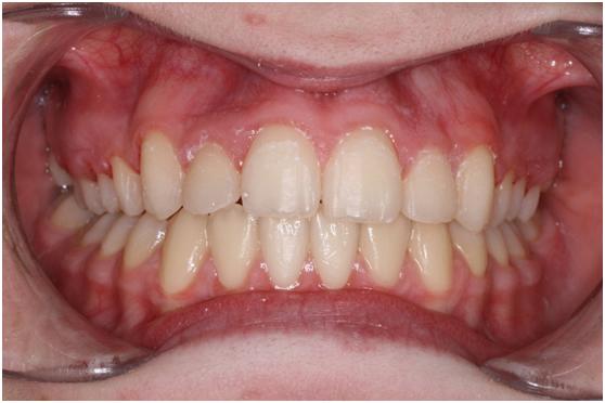Featured_smile_6
