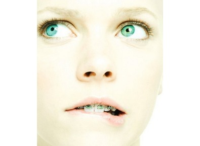 Article_image_dental-braces-care-2