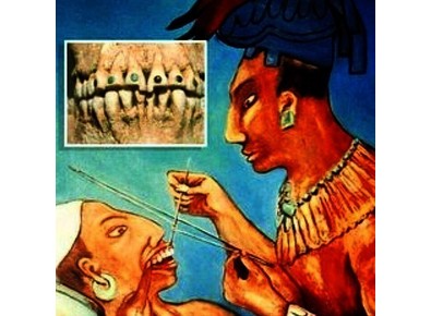 Article_image_ancient_orthodontics