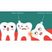 Image_gallery_thumb_wisdom_teeth_1_14323_