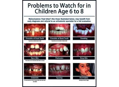 Article_image_early-ortho-treatment