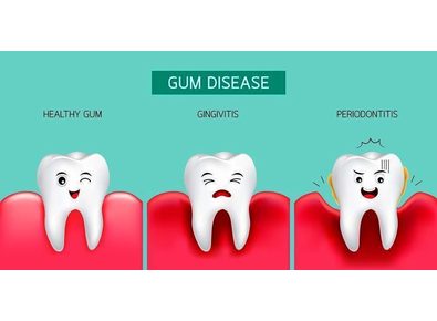 Article_image_gum