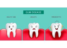 Article_thumb_gum