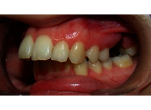 Article_thumb_image-1__1_