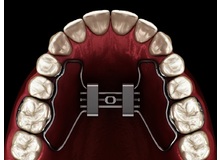 Article_thumb_image-1__1_