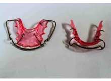 Article_thumb_do-i-need-a-hawley-retainer-after-braces-berkman-shapiro-outstanding-orthodontics