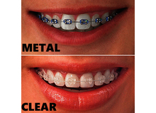 Article_thumb_image0__1_