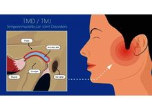 Article_thumb_image1__2_