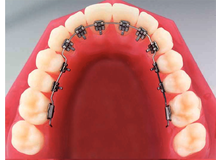 Article_thumb_image1