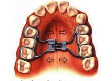 Article_thumb_image2