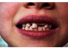 Article_thumb_image1__6_