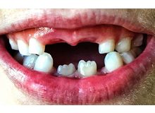 Article_thumb_image1