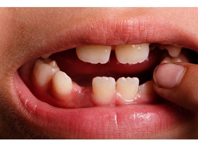 Article_image_image1__1_