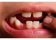 Article_thumb_image1__1_