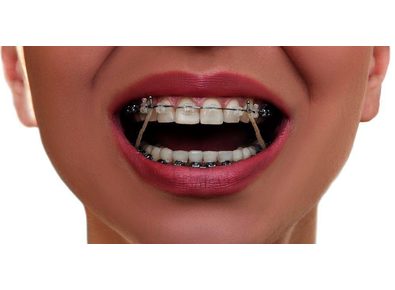 Article_image_image0__2_