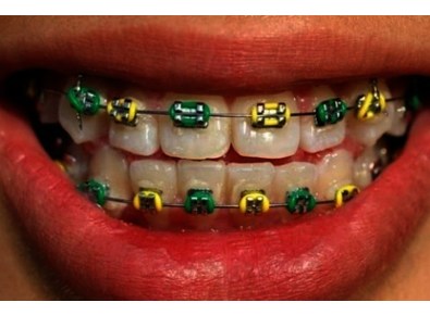 Article_image_image1