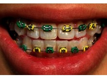 Article_thumb_image1