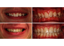 Article_thumb_image1__11_