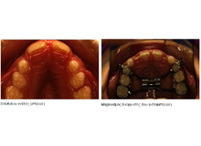 Article_thumb_image0