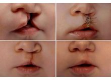 Article_thumb_image0__3_