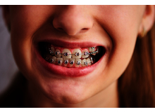 Article_thumb_image0__4_