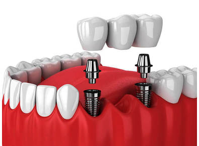 Article_image_image1__1_