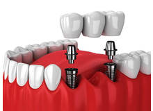 Article_thumb_image1__1_