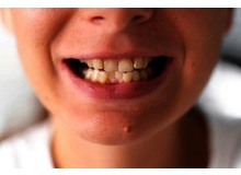 Article_thumb_image0