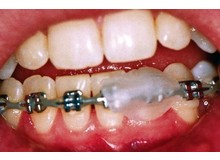 Article_thumb_image1__1_