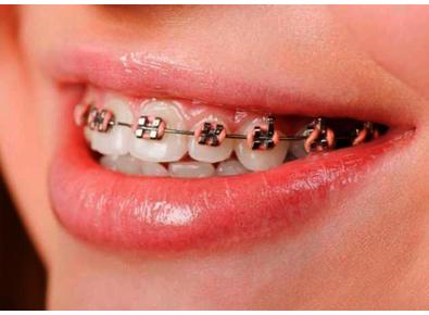 Article_image_image5