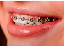 Article_thumb_image5