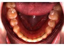 Article_thumb_image0__8_