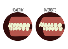 Article_thumb_image1