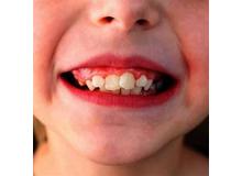 Article_thumb_image0__9_