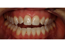 Article_thumb_image1__3_