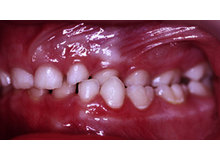 Article_thumb_image2__2_