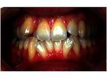 Article_thumb_image0