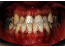 Article_thumb_image1__4_