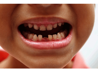 Article_image_image1