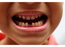 Article_thumb_image1