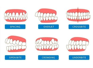 Article_image_image0__14_