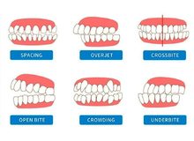 Article_thumb_image0__14_