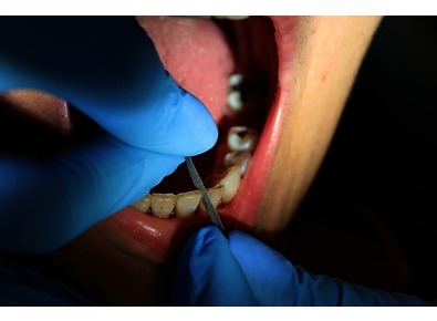 Article_image_image0__15_