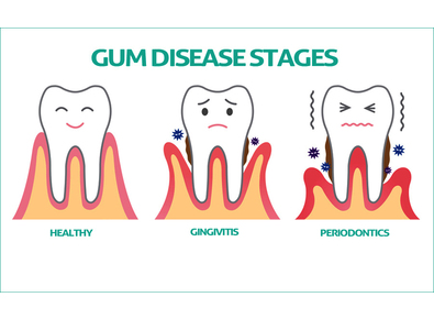 Article_image_image1__9_