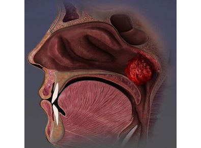 Article_image_491762451_1206809438117358_1275248304267355990_n