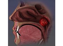 Article_thumb_491762451_1206809438117358_1275248304267355990_n