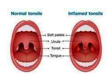 Article_thumb_____________