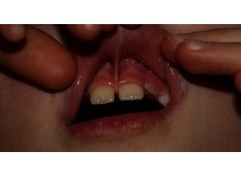 Article_thumb_1000001614