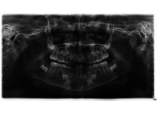 Article_thumb_1000001954