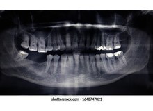Article_thumb_1000002463